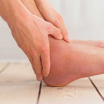 Twisted and swollen varicose veins on a patient’s ankle Vein treatment in Arcadia